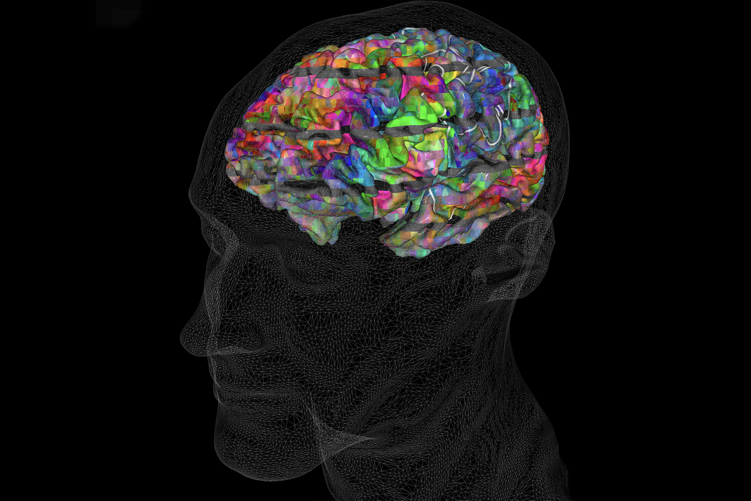 Illustration of a brain with different regions colored differently