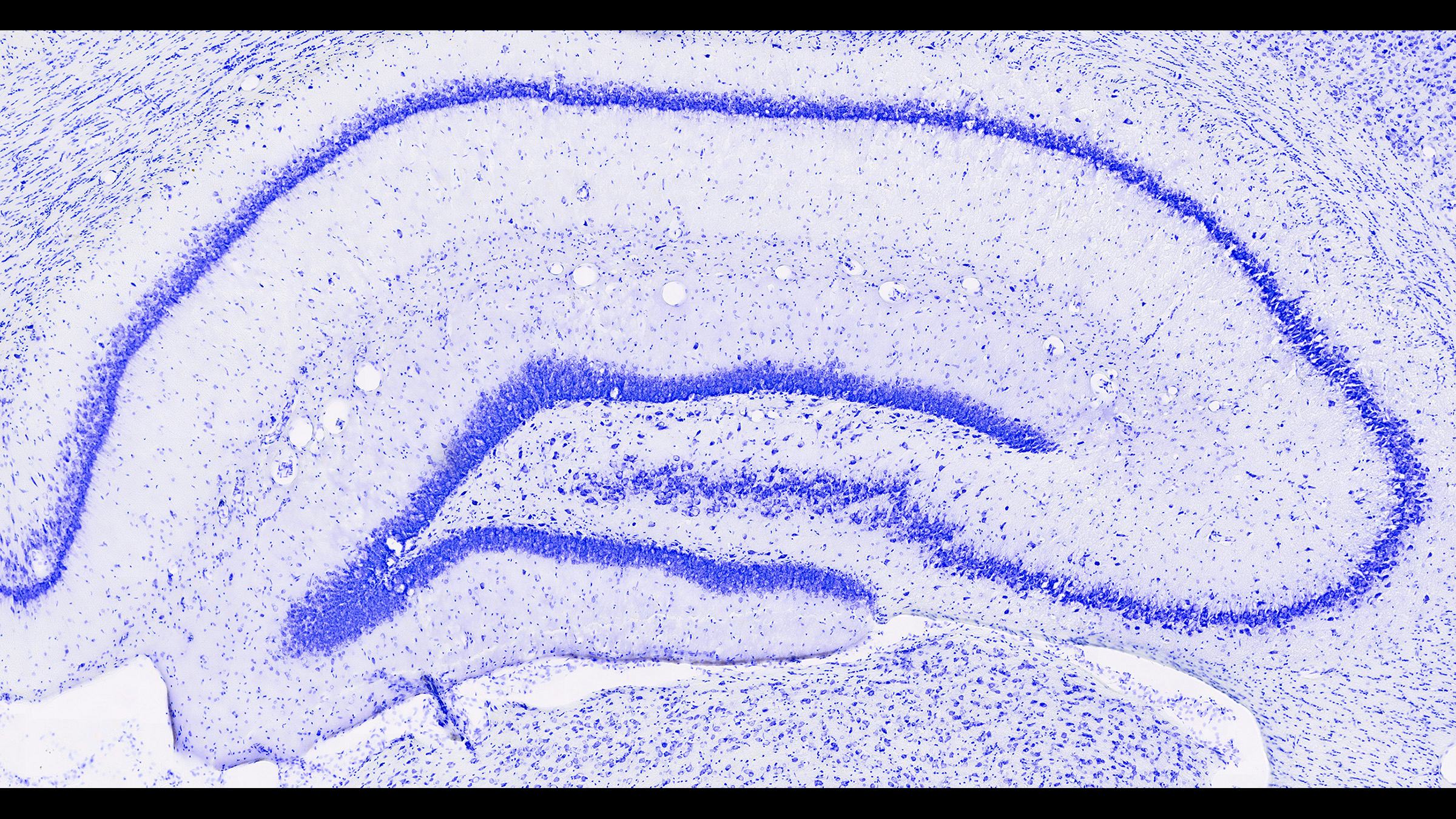 A slice of rat brain stained purple to indicate the hippocampus
