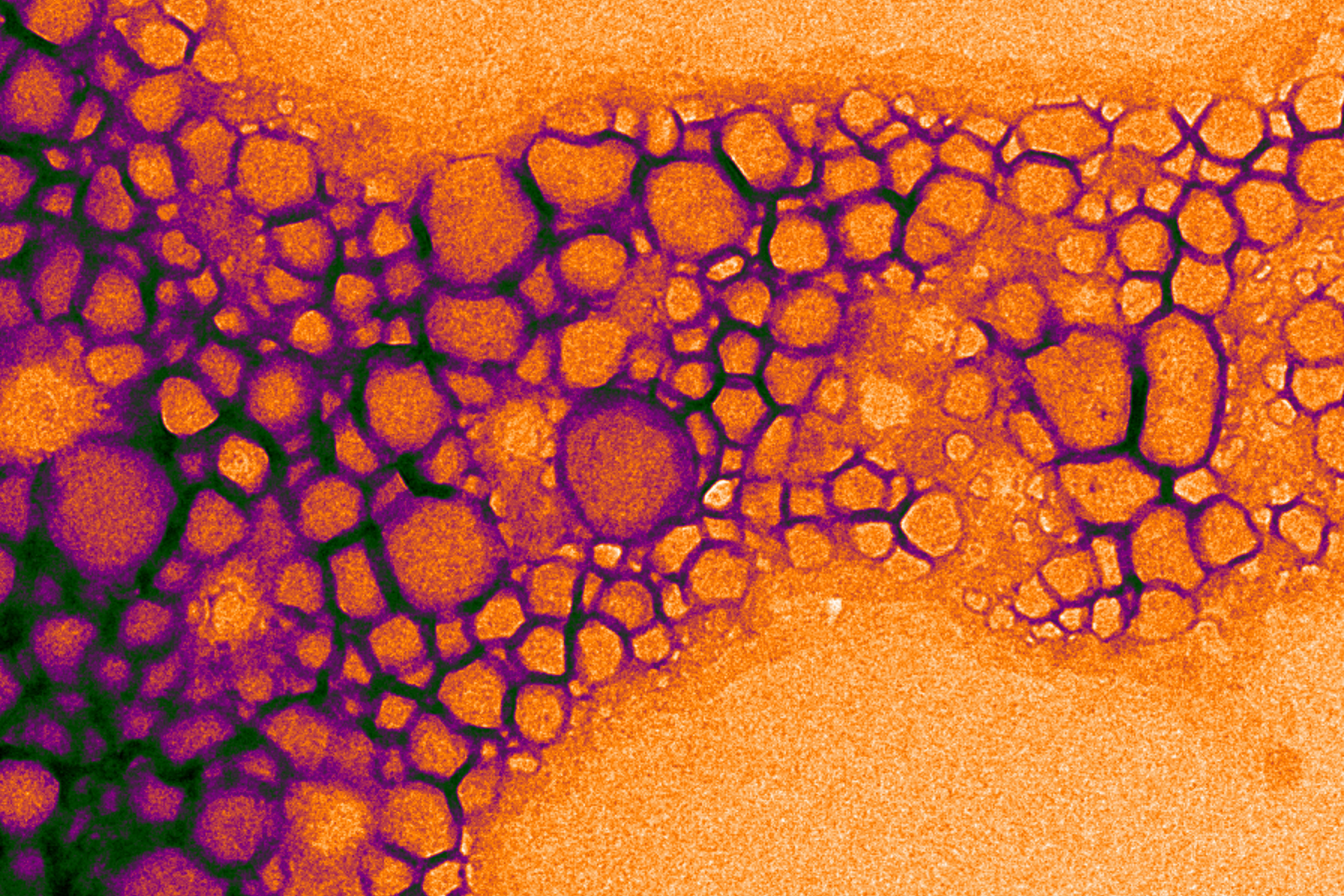 A pseudocolored transmission electron micrograph of nanodroplets filled with paramagnetic metals and perfluorocarbon materials.